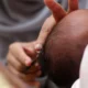 Memahami Hukum Aqiqah: Kewajiban atau Sunnah?